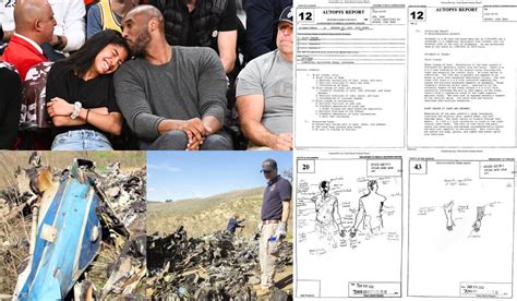 kobes autopsy|Kobe Bryant Autopsy Report: His Cause of Death。